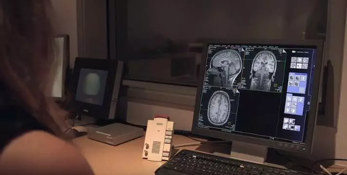 MRI results on a screen