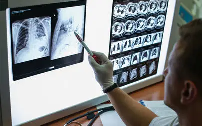 image of Instant X-ray reporting halves lung cancer diagnosis time